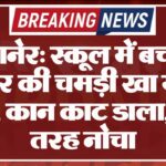 बीकानेर: स्कूल में बच्चे के सिर की चमड़ी खा गए कुत्ते, कान काट डाला, बुरी तरह नोचा